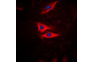 Immunofluorescent analysis of PLA2G4A (pS505) staining in HeLa cells. (PLA2G4A antibody  (pSer505))