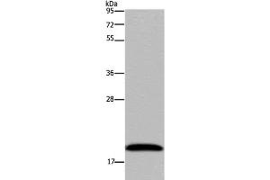 Western Blot analysis of 293T cell using NDUFA8 Polyclonal Antibody at dilution of 1:300 (NDUFA8 antibody)