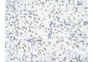 Rabbit Anti-SNRPA Antibody       Paraffin Embedded Tissue:  Human cardiac cell   Cellular Data:  Epithelial cells of renal tubule  Antibody Concentration:   4. (SNRPA1 antibody  (Middle Region))
