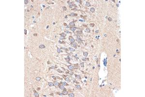 Immunohistochemistry of paraffin-embedded rat brain using P Rabbit mAb (ABIN7269161) at dilution of 1:100 (40x lens). (PAK3 antibody)