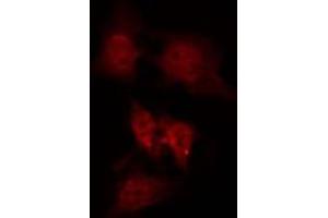 ABIN6266971 staining Hela by IF/ICC. (GPRASP1 antibody  (Internal Region))