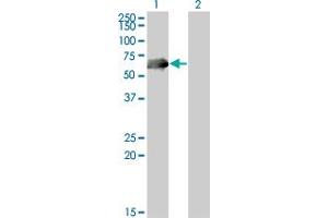 Western Blot analysis of CDC25C expression in transfected 293T cell line by CDC25C monoclonal antibody (M01A), clone 3B11. (CDC25C antibody  (AA 21-130))
