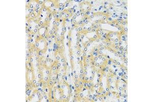 Immunohistochemistry of paraffin-embedded mouse kidney using CaMKI antibody (ABIN7266017) at dilution of 1:100 (40x lens). (CAMK1 antibody  (AA 1-93))