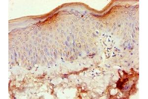 Immunohistochemistry of paraffin-embedded human skin tissue using ABIN7170845 at dilution of 1:100 (MMP3 antibody  (AA 100-477))