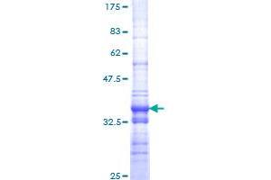 SMARCA2 Protein (AA 659-735) (GST tag)