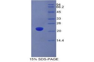 SDS-PAGE (SDS) image for Adrenomedullin (ADM) (AA 27-184) protein (His tag) (ABIN2120479)