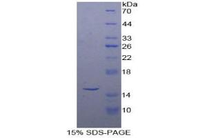 SDS-PAGE of Protein Standard from the Kit (Highly purified E. (INHBA ELISA Kit)