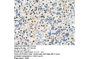 Human Liver (ZNF326 antibody  (C-Term))