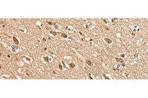 Immunohistochemistry of paraffin-embedded Human brain tissue using BATF Polyclonal Antibody at dilution of 1:45(x200)