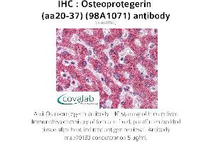 Image no. 1 for anti-Tumor Necrosis Factor Receptor Superfamily, Member 11b (TNFRSF11B) (AA 20-37) antibody (ABIN5693651) (Osteoprotegerin antibody  (AA 20-37))