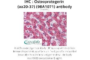 Image no. 1 for anti-Tumor Necrosis Factor Receptor Superfamily, Member 11b (TNFRSF11B) (AA 20-37) antibody (ABIN5693651)