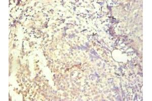 Immunohistochemical of paraffin-embedded human tonsil tissue using ABIN7156932 at dilution of 1:200. (IL-8 antibody)