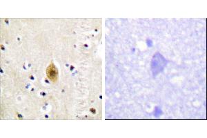Immunohistochemistry analysis of paraffin-embedded human brain tissue, using Mst1/2 (Phospho-Thr183) antibody. (MST1/MST2 (pThr183) antibody)