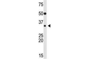 Image no. 1 for anti-Snail Family Zinc Finger 2 (SNAI2) (Middle Region) antibody (ABIN2853627) (SLUG antibody  (Middle Region))
