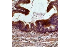Immunohistochemical analysis of STAT3 staining in human colon cancer,mouse brain formalin fixed paraffin embedded tissue section. (STAT3 antibody)