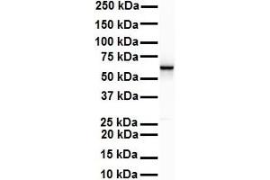WB Suggested Anti-SNRP70 antibody Titration: 1 ug/mL Sample Type: Human Raji