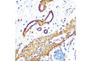 Immunohistochemistry of paraffin-embedded human colon using Filamin A Rabbit mAb (ABIN1682545, ABIN3018024, ABIN3018025 and ABIN7101570) at dilution of 1:100 (40x lens). (Filamin A antibody)