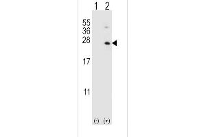 Western blot analysis of HPRT1 (arrow) using rabbit polyclonal HPRT1 Antibody (C-term) (ABIN390692 and ABIN2840982).