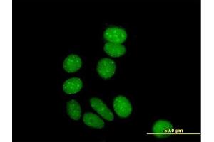 Immunofluorescence of purified MaxPab antibody to ZNF354A on MCF-7 cell. (ZNF354A antibody  (AA 1-605))