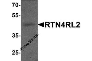 Western Blotting (WB) image for anti-Reticulon 4 Receptor-Like 2 (RTN4RL2) (C-Term) antibody (ABIN1077412) (RTN4RL2 antibody  (C-Term))