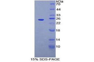 SDS-PAGE (SDS) image for Sprouty Homolog 2 (SPRY2) (AA 116-304) protein (His tag) (ABIN2126833)