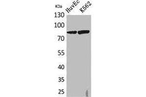 Western Blot analysis of HuvEc, K562 cells using 17β-HSD4 Polyclonal Antibody. (HSD17B4 antibody  (N-Term))