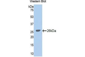 WB of Protein Standard: different control antibodies against Highly purified E. (GLDC ELISA Kit)