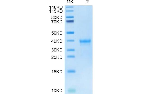 IGSF11 Protein (AA 23-241) (His tag)