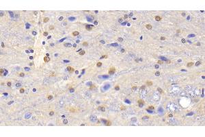 Detection of GS in Rat Cerebrum Tissue using Polyclonal Antibody to Glutamine synthetase (GS) (GLN1 antibody  (AA 1-373))