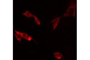 ABIN6274836 staining RAW264. (SCNN1D antibody  (C-Term))