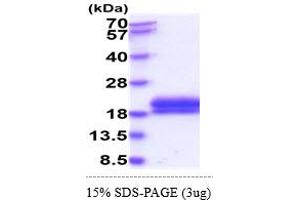 SDS-PAGE (SDS) image for Tumor Necrosis Factor Receptor Superfamily, Member 10a (TNFRSF10A) (AA 24-239) protein (His tag) (ABIN5855032)
