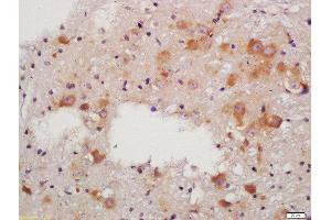 Formalin-fixed and paraffin embedded rat brain labeled with Anti-RALDH2 Polyclonal Antibody, Unconjugated  at 1:200 followed by conjugation to the secondary antibody and DAB staining (ALDH1A2 antibody  (AA 441-518))