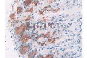 Immunohistochemistry (IHC) image for anti-Nucleophosmin (Nucleolar phosphoprotein B23, Numatrin) (NPM1) (AA 212-292) antibody (ABIN7438103)
