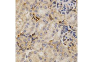 Immunohistochemistry (IHC) image for anti-ELAV (Embryonic Lethal, Abnormal Vision, Drosophila)-Like 1 (Hu Antigen R) (ELAVL1) (AA 1-326) antibody (ABIN3022231)