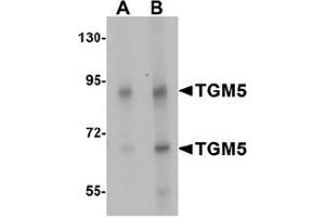 Western blot analysis of TGM5 in rat heart tissue lysate with TGM5 Antibody  at (A) 1 and (B) 2 ug/mL.