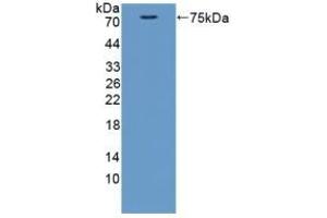 Detection of Recombinant CTTN, Mouse using Polyclonal Antibody to Cortactin (CTTN) (Cortactin antibody  (AA 1-509))