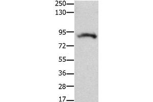 Western Blot analysis of Mouse brain tissue using KCNH2 Polyclonal Antibody at dilution of 1:100 (KCNH2 antibody)