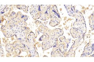 Detection of CGb in Human Placenta Tissue using Monoclonal Antibody to Chorionic Gonadotropin Beta Polypeptide (CGb) (CGB antibody  (AA 31-165))