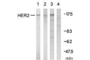 Western blot analysis of extracts from A2780 cells, using HER2 (Ab-1248) Antibody. (ErbB2/Her2 antibody  (AA 1206-1255))