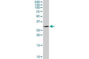 CBR1 MaxPab rabbit polyclonal antibody. (CBR1 antibody  (AA 1-277))