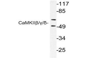 Western blot (WB) analysis of CaMKIIbeta/gamma/delta antibody in extracts from rat brain cells. (CAMK2B antibody)