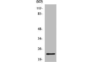 Western Blot analysis of K562 cells using CD179b Polyclonal Antibody (IGLL1/IGLC1/IGLC6/IGLC7 (N-Term) antibody)