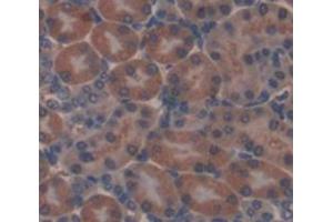 Figure. (TRIP6 antibody  (AA 281-471))