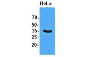 The extracts of HeLa (50 ug) were resolved by SDS-PAGE, transferred to PVDF membrane and probed with anti-human EIF2S1 (1:1000). (EIF2S1 antibody  (AA 1-315))