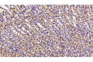 Immunohistochemistry (IHC) image for anti-Caveolin 1, Caveolae Protein, 22kDa (CAV1) (AA 2-105) antibody (ABIN7431326)