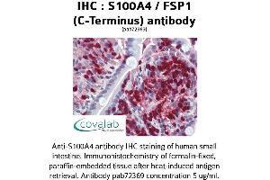 Image no. 2 for anti-S100 Calcium Binding Protein A4 (S100A4) (C-Term) antibody (ABIN1739005) (s100a4 antibody  (C-Term))