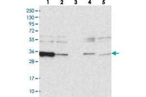 Western blot analysis of Lane 1: RT-4, Lane 2: U-251 MG, Lane 3: Human Plasma, Lane 4: Liver, Lane 5: Tonsil with ACTR6 polyclonal antibody . (ACTR6 antibody)
