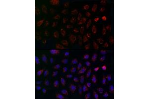 Immunofluorescence analysis of A-549 cells using MCU Rabbit pAb (ABIN7268549) at dilution of 1:200 (40x lens). (MCU antibody  (AA 1-351))
