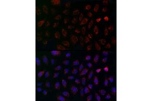 Immunofluorescence analysis of A-549 cells using MCU Rabbit pAb (ABIN7268549) at dilution of 1:200 (40x lens).