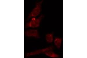 ABIN6274038 staining HepG2 by IF/ICC. (Melanoma gp100 antibody  (C-Term))